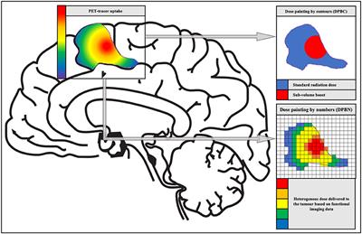 The Path Toward PET-Guided Radiation Therapy for Glioblastoma in Laboratory Animals: A Mini Review